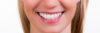 Dental Bleaching - 20% off
